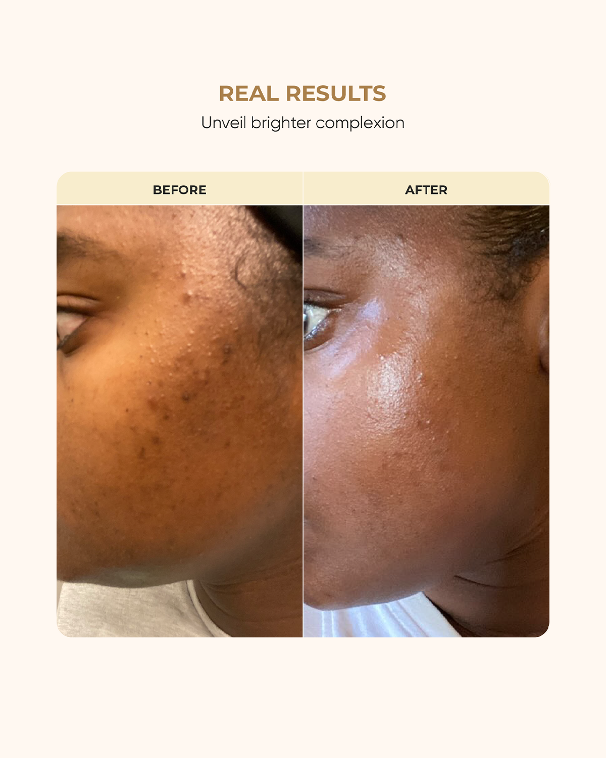 Customizable Skin Kit