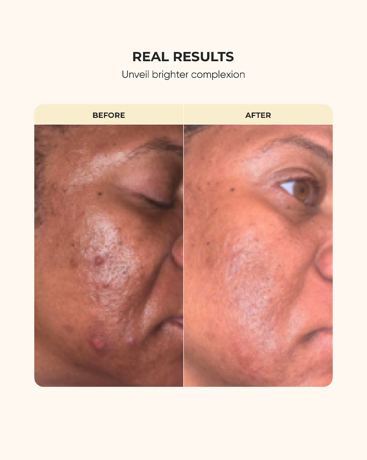 Supreme Customizable Skin Kit