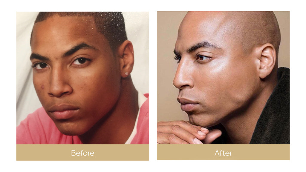 Dark Spot Skincare Routine For Black Men