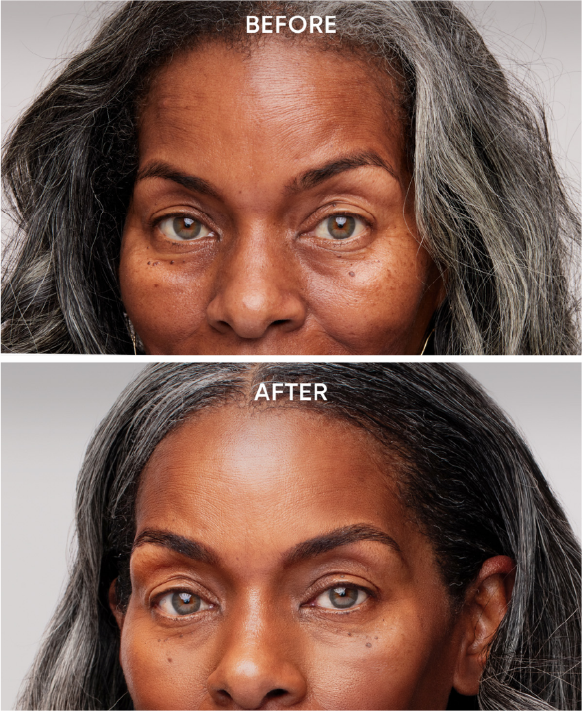 Dark Spot Fade Set | Buttah Skin