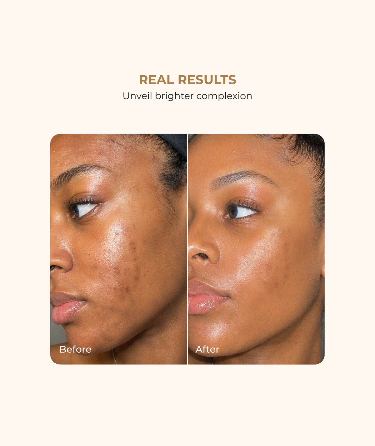 Glow On The Go Holiday Skincare Set
